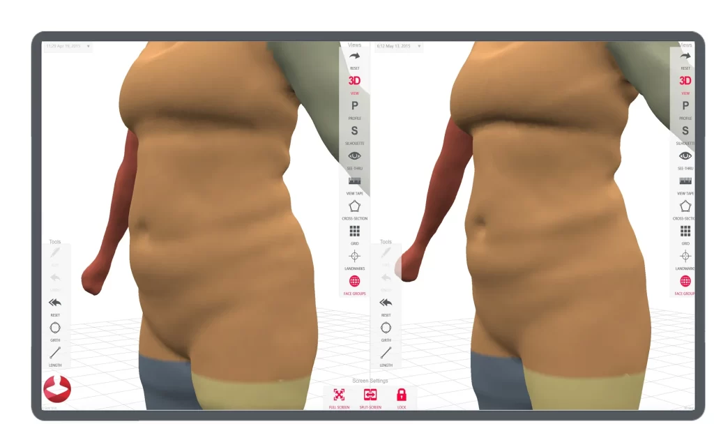 3D body profiling