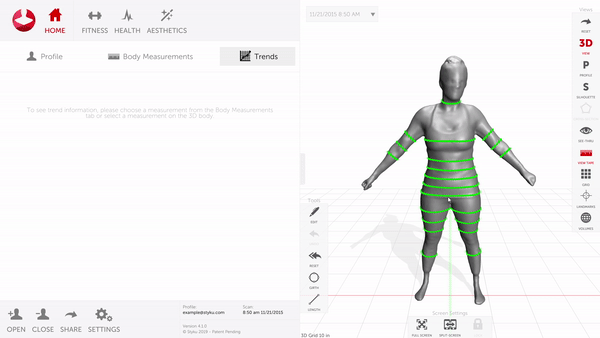 3D body analysis